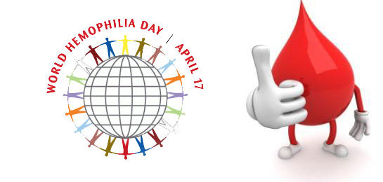 Hemophilia: A Serious Incurable Bleeding Disorder