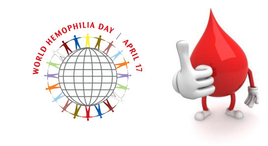Hemophilia: A Serious Incurable Bleeding Disorder